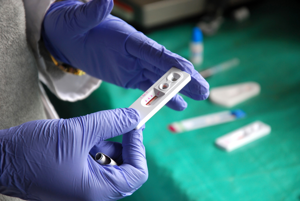 Japão. Investigadores descobrem em humanos uma proteína inibidora do VIH