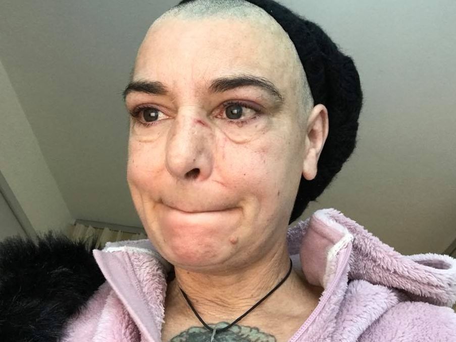 Sinéad O’Connor confessa que filho lhe bateu