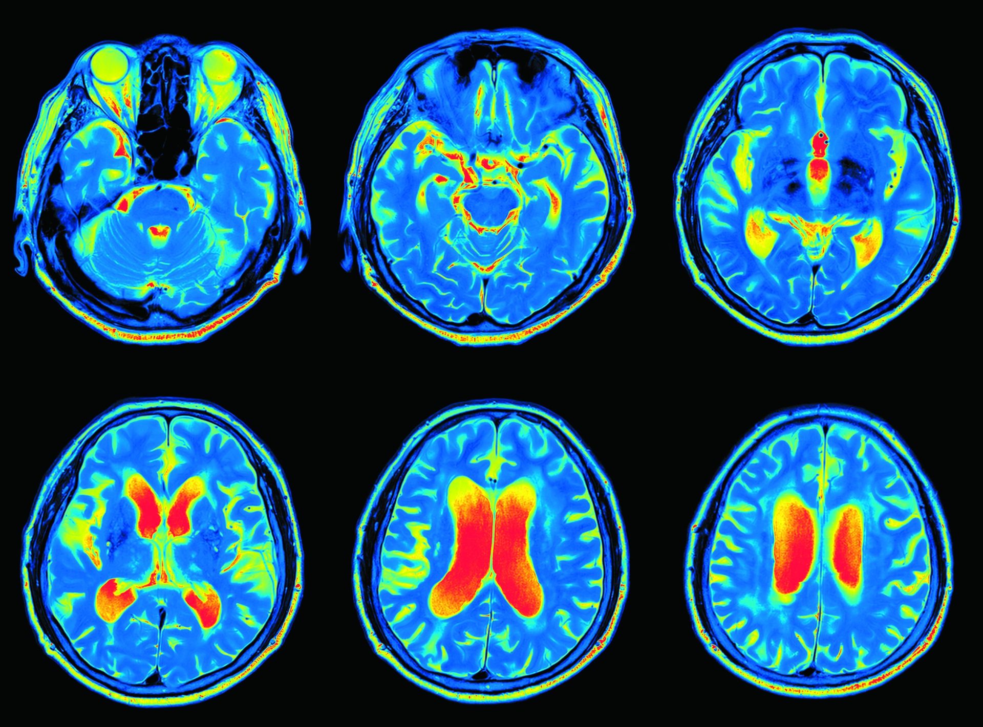 Neurociência cognitiva. Projeto português quer desenhar um mapa do cérebro