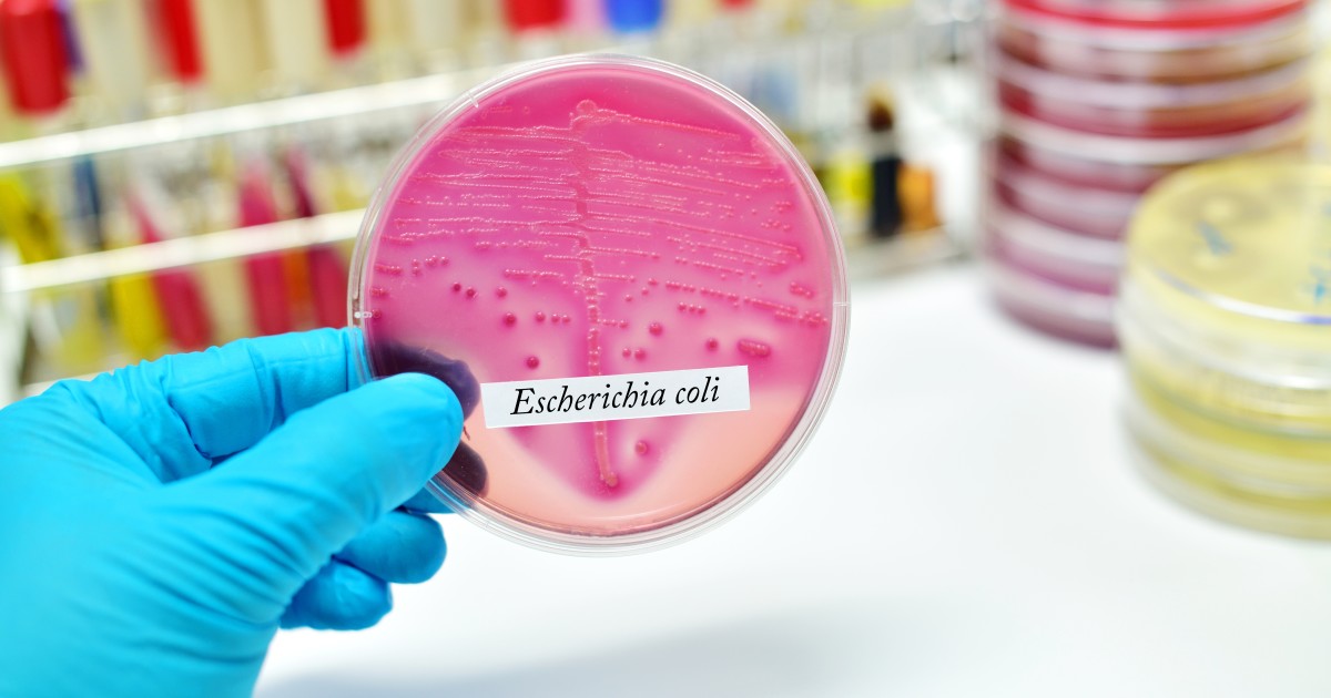 E. coli detetada em suplemento alimentar