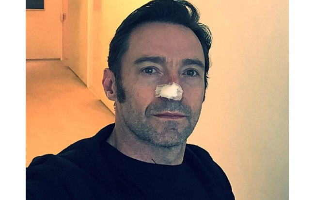 Ator Hugh Jackman enfrenta cancro… pela sexta vez