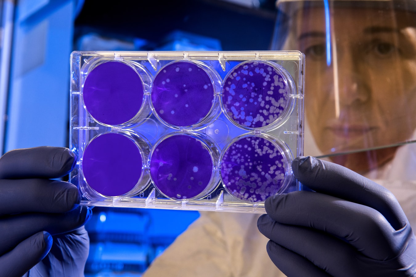 Covid-19. Número de casos da variante mais contagiosa em Portugal sobe para 72