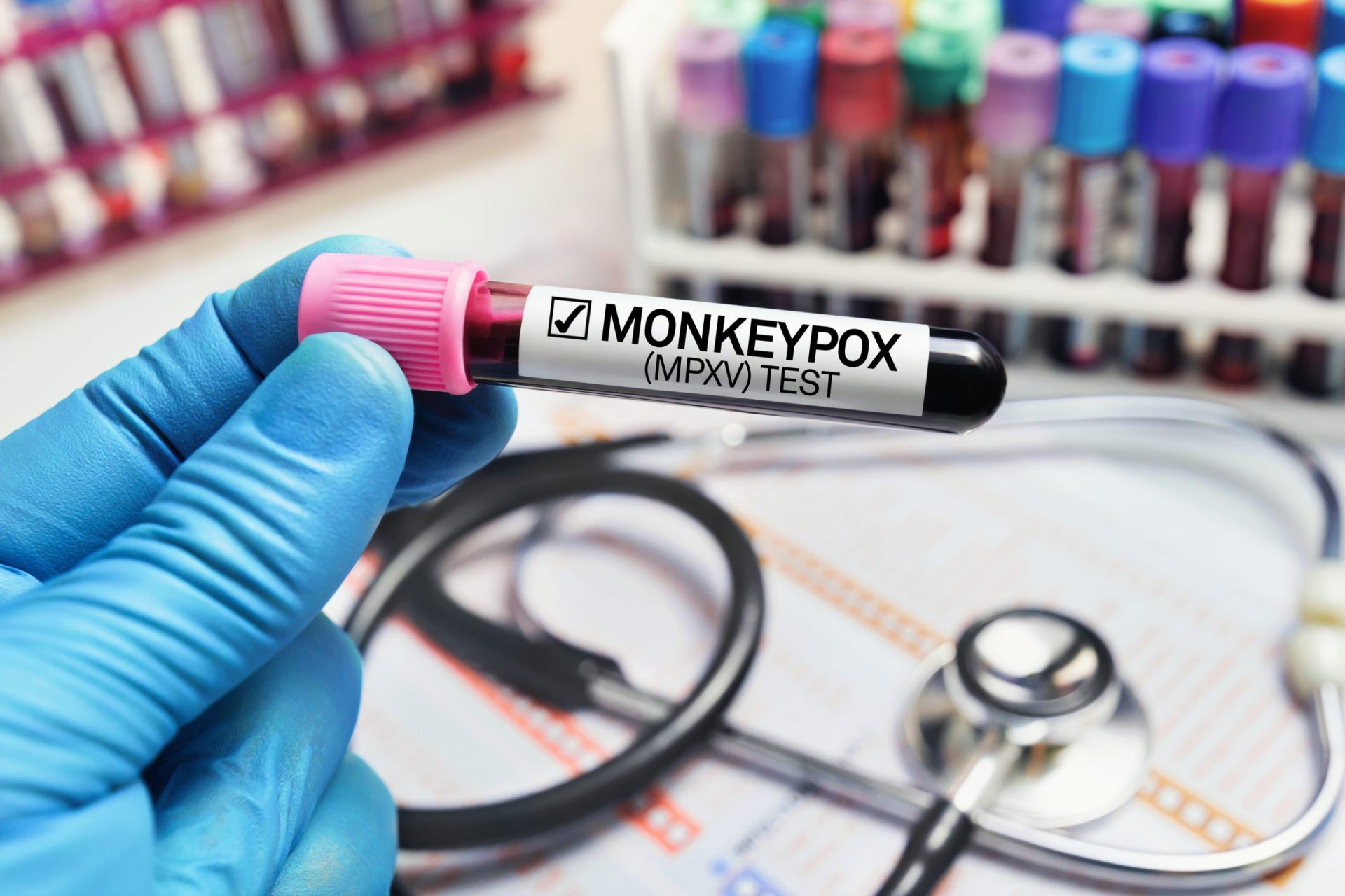 Monkeypox. DGS alarga vacinação preventiva a pessoas de grupos de risco