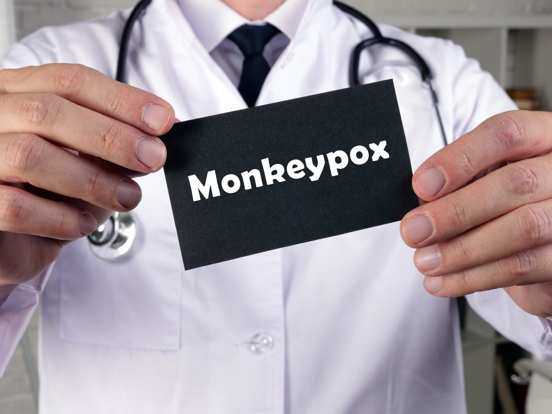 Registado primeiro caso de infeção por Monkeypox na Madeira