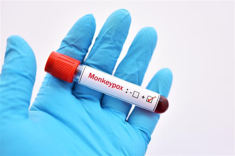 Monkeypox. OMS recomenda redução do número de parceiros sexuais para reduzir nível de transmissão