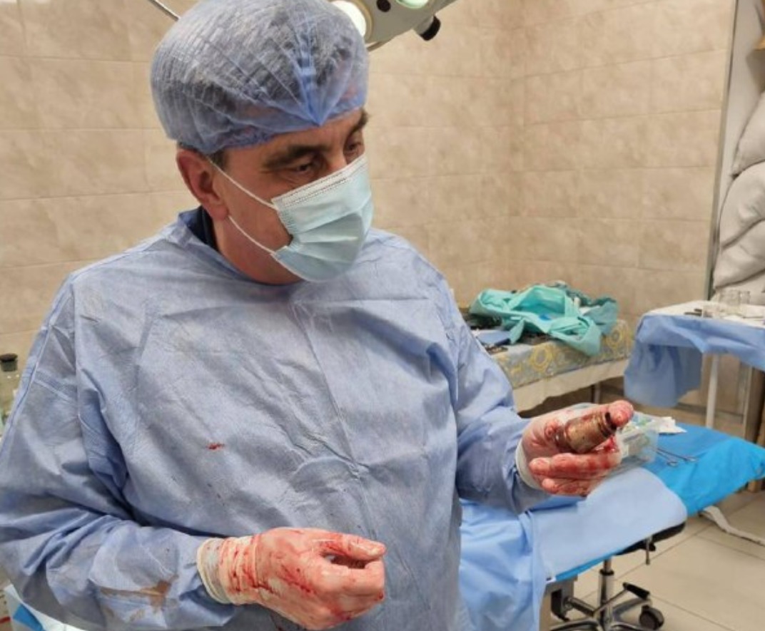 Guerra. Médicos removem granada por explodir de corpo de soldado ucraniano